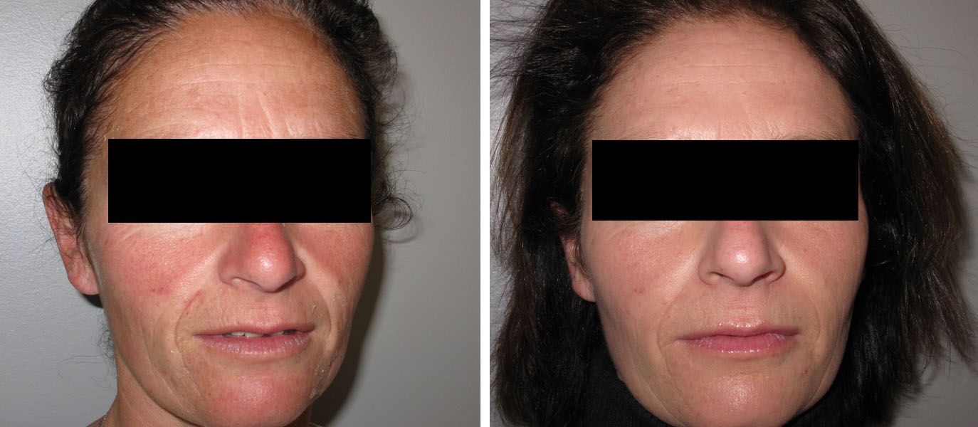 Un visage plus rayonnant grâce à la médecine esthétique Un visage plus rayonnant grâce à la médecine esthétique